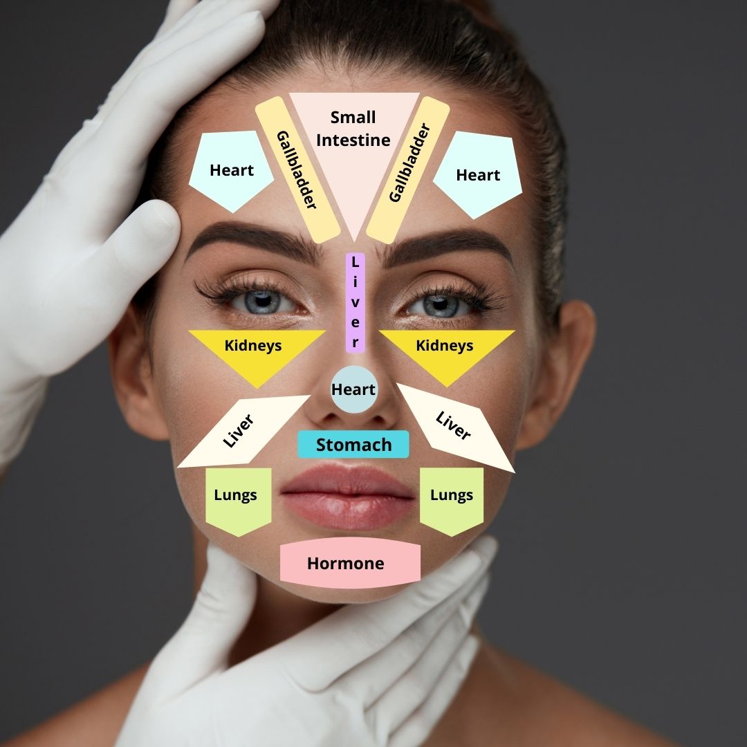 Face mapping your acne and what it means on your face revealed