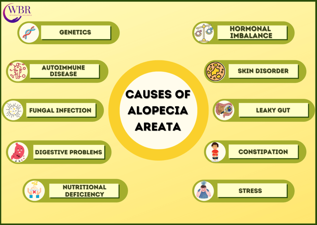 Cause of Alopecia areata