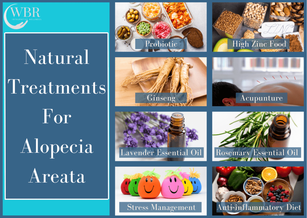 Natural Treatments For Alopecia Areata