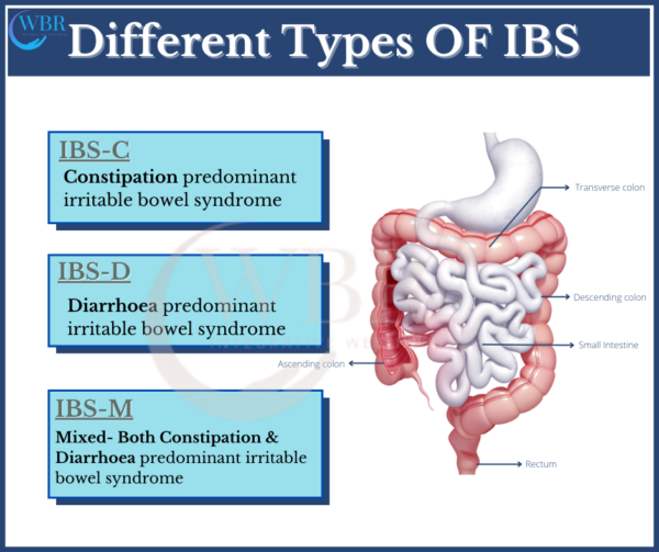 How to manage Irritable Bowel Syndrome (IBS) naturally. Wellness By