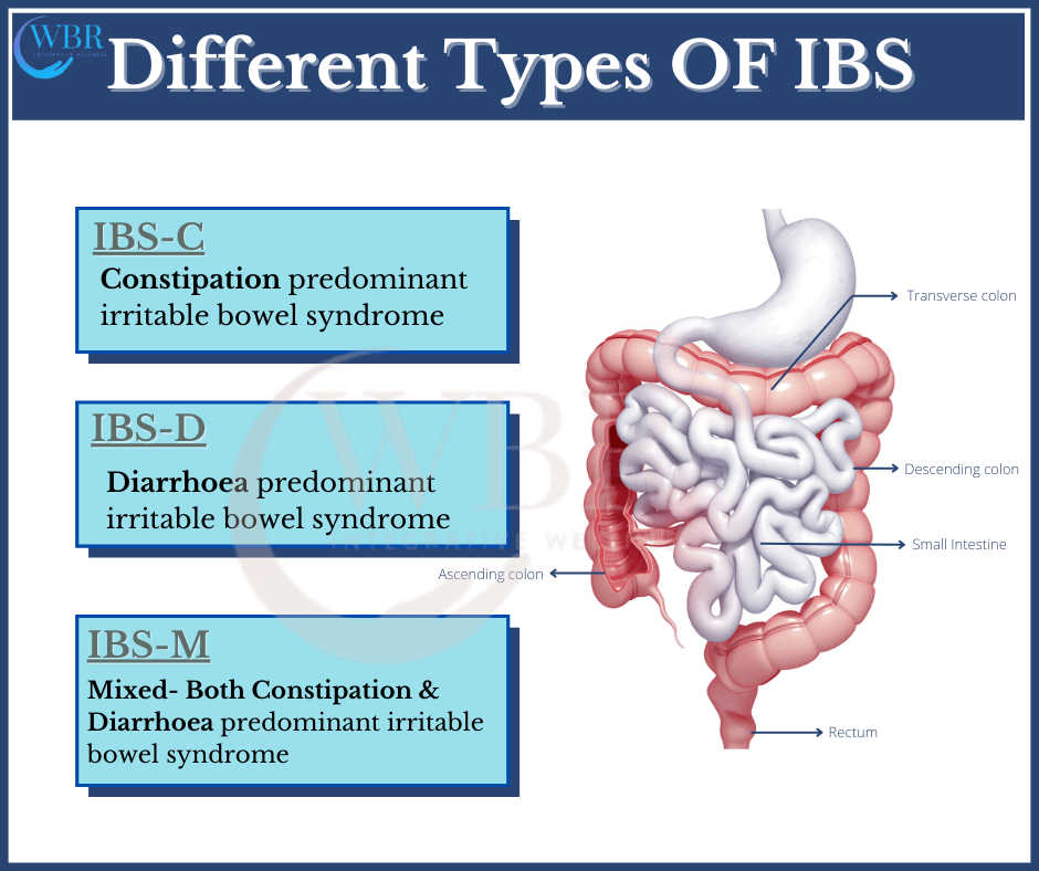 Subtypes Of IBS Know The About IBS 59 OFF