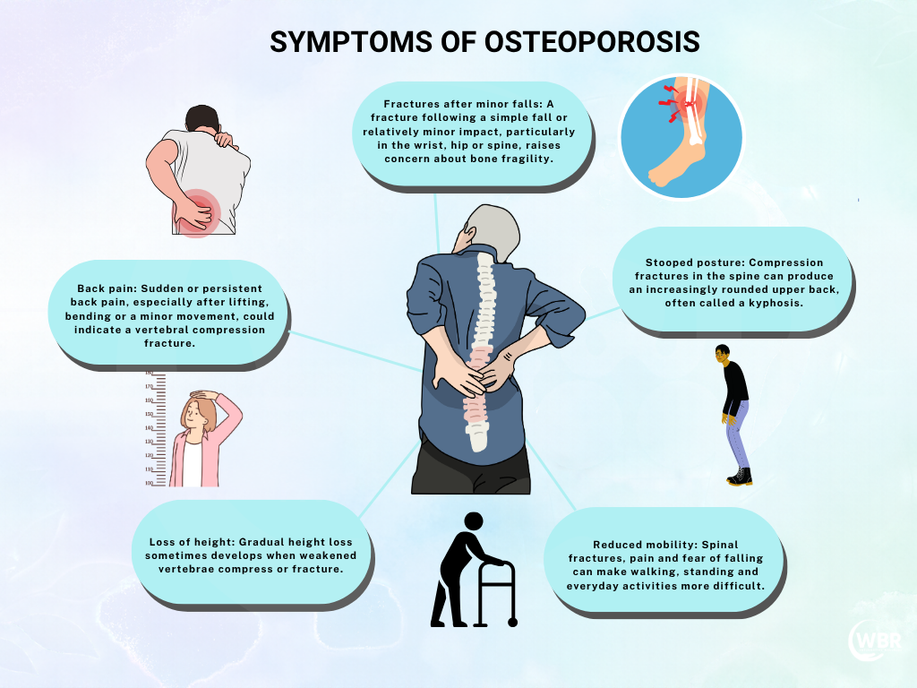 SYMPTOMS OF OSTEOPOROSIS